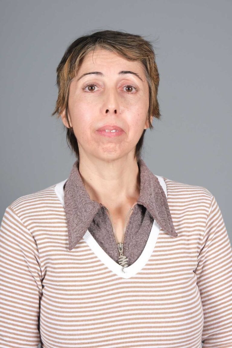 Yıldız Önal